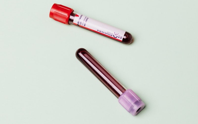 vials of blood